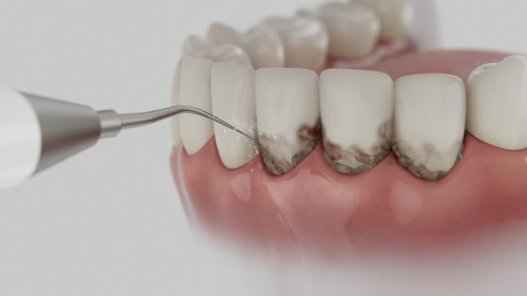 Trusted Tooth Extraction service in Lake Royale, NC - Dentist Open Now